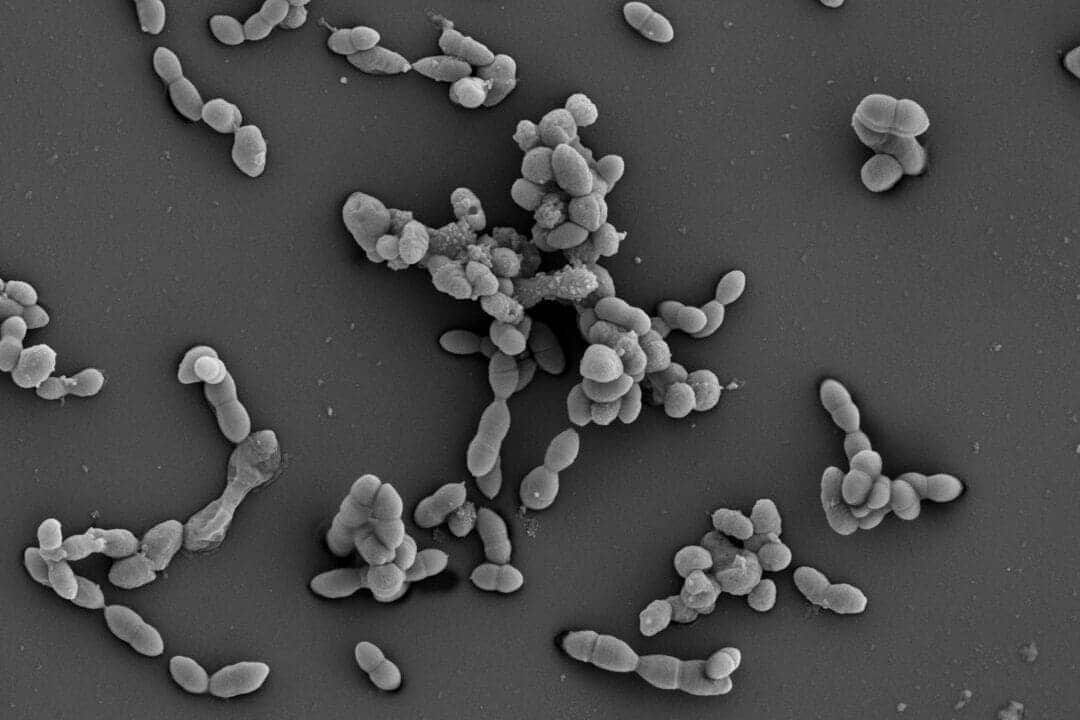 Oenococcus oeni lactic acid bacteria malolactic fermentation